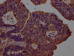 CXCL10/IP-10/CRG-2 Antibody (5C7), Novus Biologicals 50 &mu;L, Unconjugated:Antibodies,