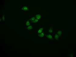 Cystatin B/Stefin B Antibody (11H4), Novus Biologicals:Antibodies:Primary