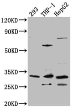 COMT Antibody (8E1), Novus Biologicals:Antibodies:Primary Antibodies