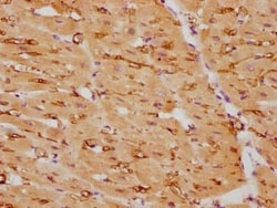 Calponin 1 Antibody (2H1), Novus Biologicals:Antibodies:Primary Antibodies