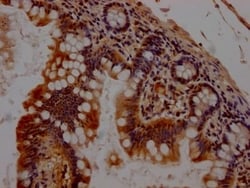 Chk1 Antibody (2F2), Novus Biologicals:Antibodies:Primary Antibodies