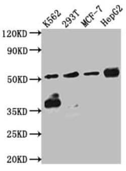 Chk1 Antibody (2F2), Novus Biologicals:Antibodies:Primary Antibodies