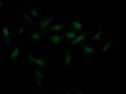 Chk1 Antibody (2F2), Novus Biologicals:Antibodies:Primary Antibodies
