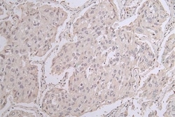Choline Acetyltransferase/ChAT Antibody (8E7), Novus Biologicals 100 &mu;L,