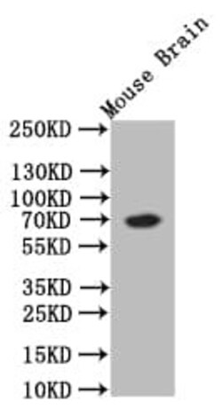 Choline Acetyltransferase/ChAT Antibody (8E7), Novus Biologicals 100 &mu;L,