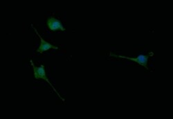 Choline Acetyltransferase/ChAT Antibody (8E7), Novus Biologicals 100 &mu;L,