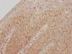 CDK2 Antibody (6A5), Novus Biologicals:Antibodies:Primary Antibodies