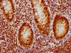 CDC5L Antibody (1E3), Novus Biologicals:Antibodies:Primary Antibodies