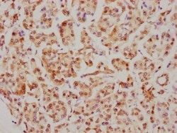 CDC5L Antibody (1E3), Novus Biologicals:Antibodies:Primary Antibodies