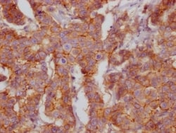 CD46 Antibody (7D12), Novus Biologicals:Antibodies:Primary Antibodies