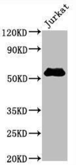CD4 Antibody (2B7), Novus Biologicals 100 &mu;L, Unconjugated:Antibodies,