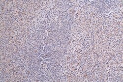 CD36 Antibody (13B12), Novus Biologicals:Antibodies:Primary Antibodies