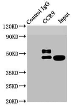 CCR9 Antibody (4G2), Novus Biologicals 50 &mu;L | Buy Online | Novus Biologicals | Fisher Scientific
