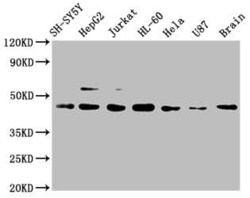 CCR9 Antibody (4G2), Novus Biologicals 50 &mu;L | Buy Online | Novus Biologicals | Fisher Scientific