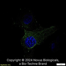 Novus Biologicals Optineurin Antibody, Novus Biologicals 0.1 mg, Unconjugated:Antibodies,