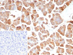 Novus Biologicals Pancreatic Lipase Antibody (PNLIP/8913), Novus Biologicals