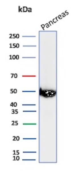 Novus Biologicals Pancreatic Lipase Antibody (PNLIP/8913), Novus Biologicals