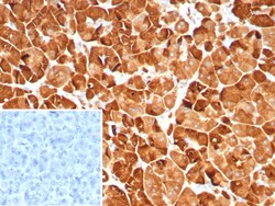 Novus Biologicals Pancreatic Lipase Antibody (PNLIP/9039), Novus Biologicals