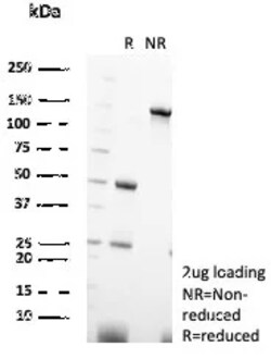 Novus Biologicals Parvalbumin alpha Antibody (PVALB/7601), Novus Biologicals