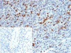 Novus Biologicals S100A13 Antibody (S100A13/7483), Novus Biologicals:Antibodies:Primary
