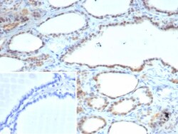 Novus Biologicals S100A13 Antibody (S100A13/7484), Novus Biologicals:Antibodies:Primary