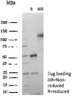 Novus Biologicals SDHA Antibody (SDHA/7491), Novus Biologicals:Antibodies:Primary