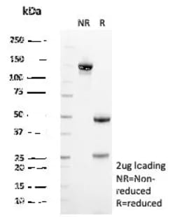 Novus Biologicals SDHA Antibody (SDHA/7492), Novus Biologicals 20 &mu;g,