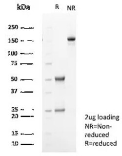 Novus Biologicals TGF-beta 2 Antibody (TGFB2/1679), Novus Biologicals:Antibodies:Primary