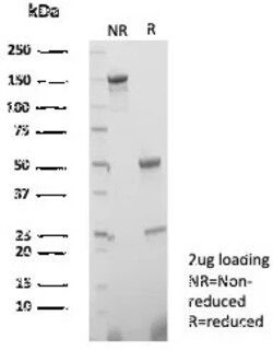 Novus Biologicals TGF-beta 3 Antibody (TGFB3/4801), Novus Biologicals 20