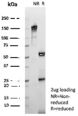 Novus Biologicals Tryptophan Hydroxylase 1/TPH-1 Antibody (TPH1/7661),
