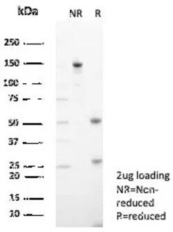 Novus Biologicals Tryptophan Hydroxylase 1/TPH-1 Antibody (TPH1/7662),