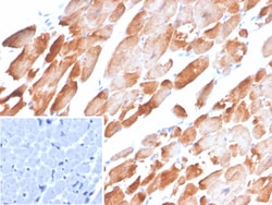 Novus Biologicals Tropomyosin-1 Antibody (TPM1/4510), Novus Biologicals:Antibodies:Primary