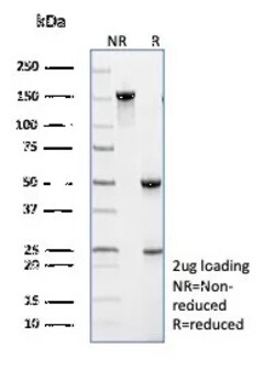 Novus Biologicals TRAF-1 Antibody (TRAF1/3299), Novus Biologicals:Antibodies:Primary