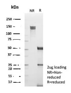 Novus Biologicals TRAF-1 Antibody (TRAF1/3365), Novus Biologicals 100 &mu;g | Buy Online | Novus Biologicals&trade; | Fisher Scientific