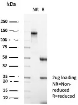 Novus Biologicals Carbonic Anhydrase III/CA3 Antibody (CA3/7883), Novus Biologicals 100 &mu;g | Buy Online | Novus Biologicals&trade; | Fisher Scientific