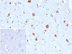 Novus Biologicals Carbonic Anhydrase VIII/CA8 Antibody (CA8/6814), Novus