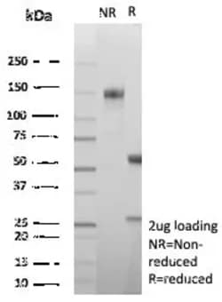 Novus Biologicals Carbonic Anhydrase VIII/CA8 Antibody (CA8/8605R), Novus