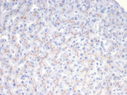 Novus Biologicals ABCB11 Antibody (BSEP/7534), Novus Biologicals:Antibodies:Primary