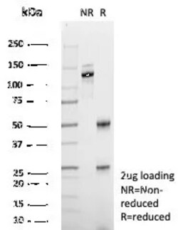 Novus Biologicals ABCB11 Antibody (BSEP/7534), Novus Biologicals:Antibodies:Primary