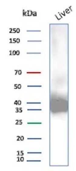 Novus Biologicals Aldo-keto Reductase 1C1/AKR1C1 Antibody (AKR1C1/9070),