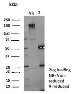 Novus Biologicals Aldo-keto Reductase 1C1/AKR1C1 Antibody (AKR1C1/9070),