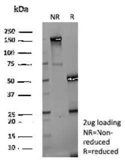 Novus Biologicals Aldo-keto Reductase 1C1/AKR1C1 Antibody (AKR1C1/9069),