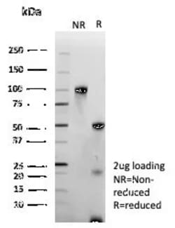 Novus Biologicals ERG Antibody (ERG/9122R), Novus Biologicals 20 &mu;g,