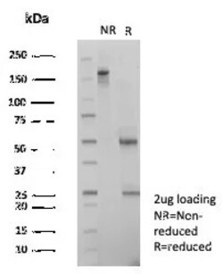 Novus Biologicals SNW1 Antibody (PCRP-SNW1-1C12), Novus Biologicals 100