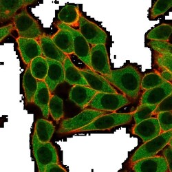 Novus Biologicals SNW1 Antibody (PCRP-SNW1-1C12), Novus Biologicals 100