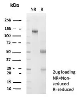 Novus Biologicals SNW1 Antibody (PCRP-SNW1-2A1), Novus Biologicals 20 &mu;g,