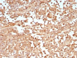 Novus Biologicals PRAME Antibody (PRAME/9188), Novus Biologicals:Antibodies:Primary