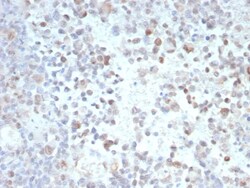 Novus Biologicals PRAME Antibody (PRAME/9189), Novus Biologicals 100 &mu;g | Buy Online | Novus Biologicals&trade; | Fisher Scientific