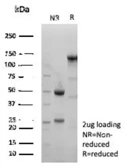 Novus Biologicals xCT Antibody (SLC7A11/9136R), Novus Biologicals 20 &mu;g,