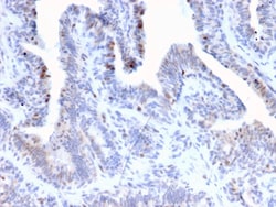 Novus Biologicals LRH-1/NR5A2 Antibody (PCRP-NR5A2-1B8), Novus Biologicals:Antibodies:Primary